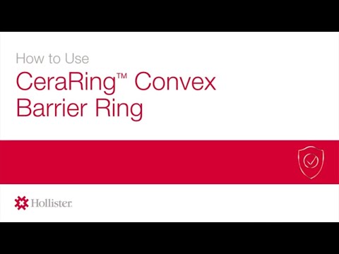 How to use CeraRing™ Convex Barrier Ring | Hollister