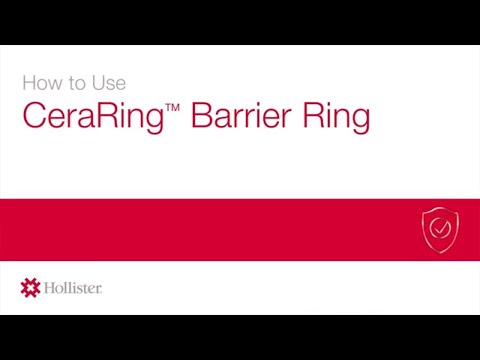 How to use CeraRing™ Barrier Ring | Hollister