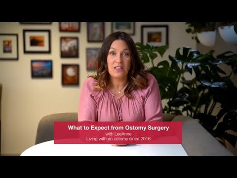 What to Expect from Ostomy Surgery with LeeAnne | H ...