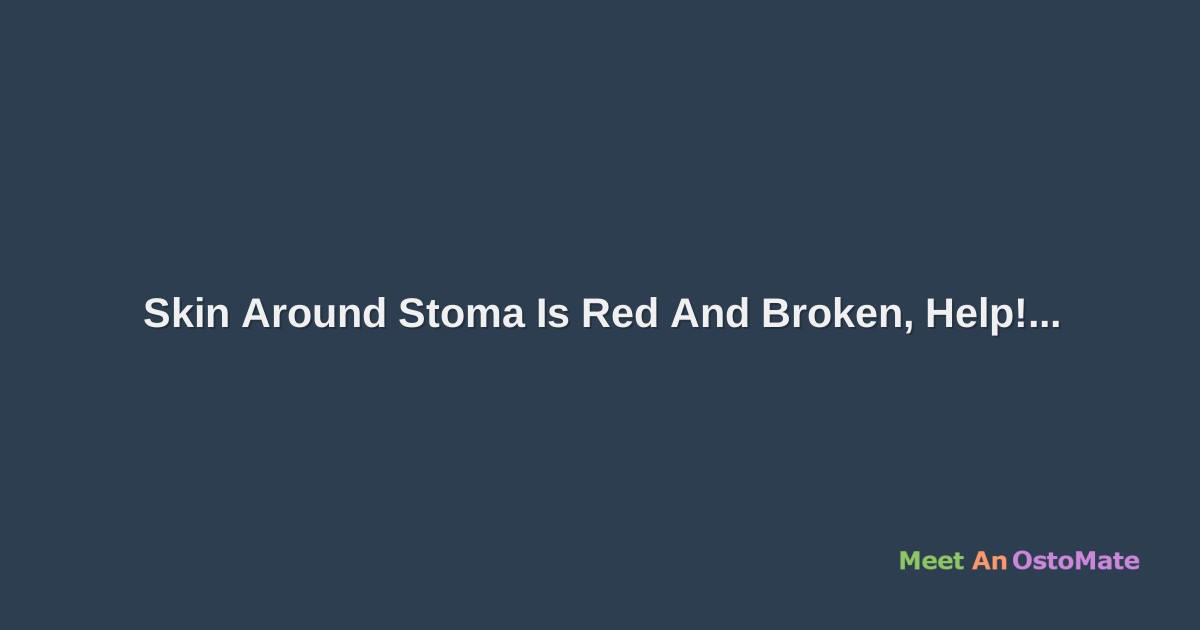 Skin Around Stoma Is Red And Broken, Help!