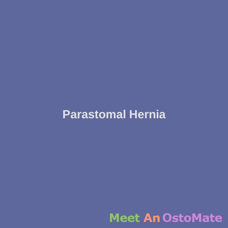 Parastomal Hernia Lifting Guidelines And Employer Issues parastomal-hernia-lifting-guidelines-and-employer-issues