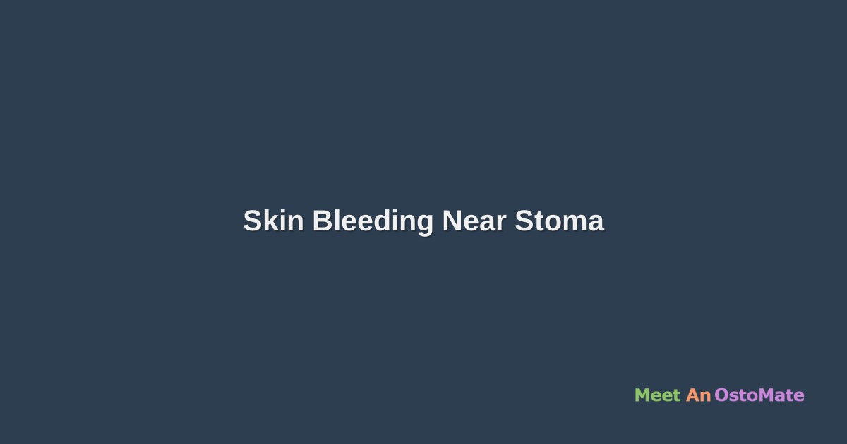 Skin Bleeding Near Stoma